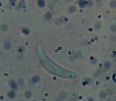 Mitrula lunulatospora