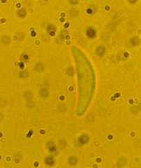 Mitrula lunulatospora