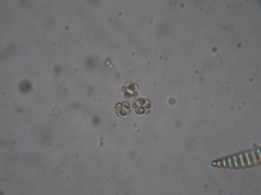 Coelastrum