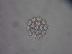 Pseudopediastrum boryanum