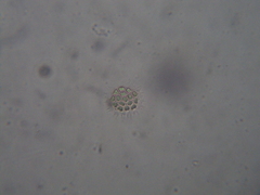 Hydrodictyaceae