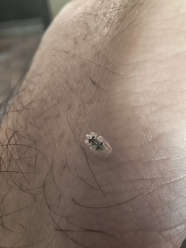Eastern Sycamore Lace Bug