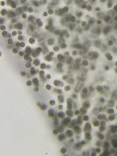 Microcystis aeruginosa observed 2026-09-22