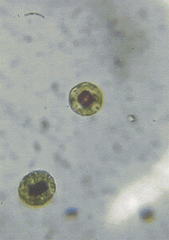 Haematococcus