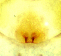 Philodromus anomalus