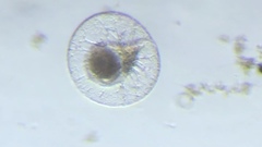 Noctiluca scintillans