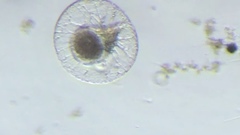 Noctiluca scintillans