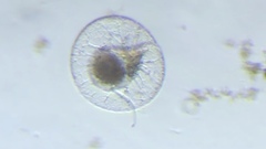 Noctiluca scintillans