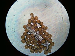 Puccinia orbicula