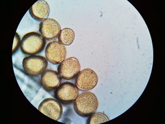 Puccinia orbicula