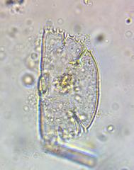 Micrasterias truncata