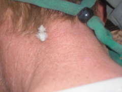 Dasymutilla gloriosa