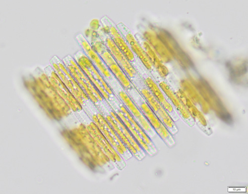 carpenter's rule diatom