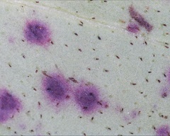 Mycosphaerella stemmatea