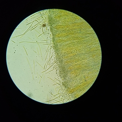Coccomyces castanopsidis
