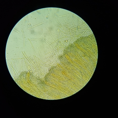 Coccomyces castanopsidis