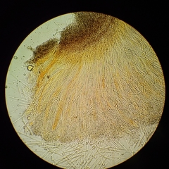 Coccomyces castanopsidis