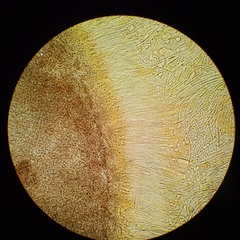 Coccomyces castanopsidis