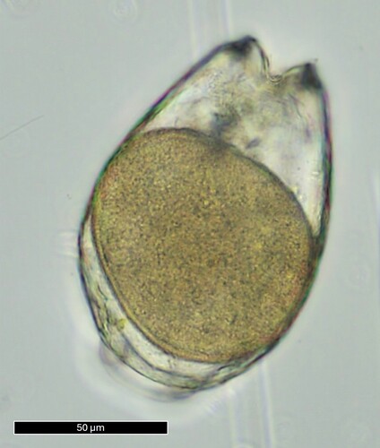 Lecane bulla