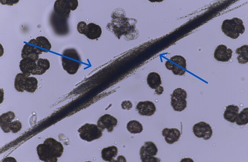 Aphanizomenon flosaquae observed 2026-09-29