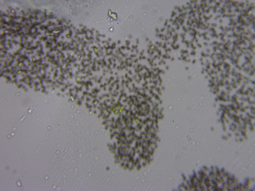 Microcystis aeruginosa observed 2026-09-30