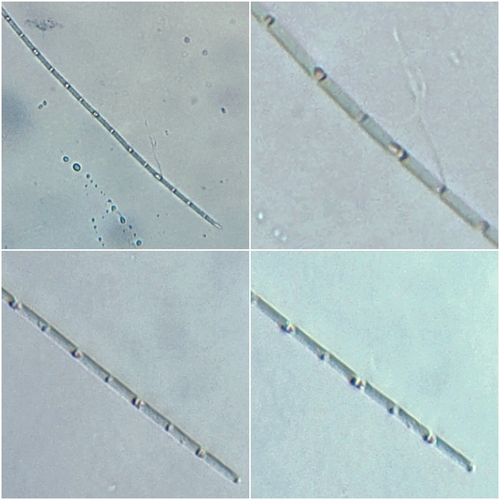 Oscillatoria observed 2026-09-20