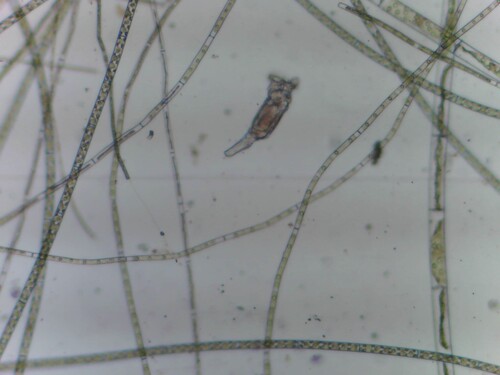 Philodina megalotrocha