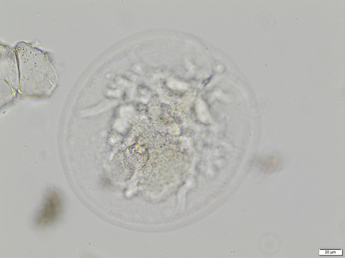 Testudinella patina