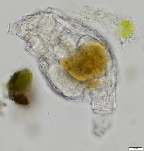 Philodina megalotrocha