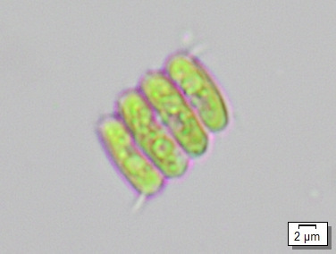 Desmodesmus intermedius