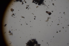 Gastrotricha