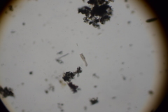 Gastrotricha
