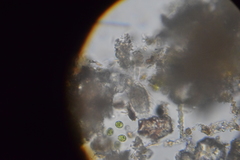 Gastrotricha