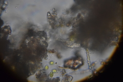 Gastrotricha
