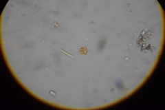 Heliozoa