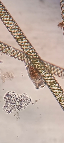 Philodina megalotrocha