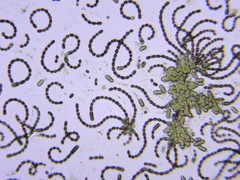 Dolichospermum lemmermannii