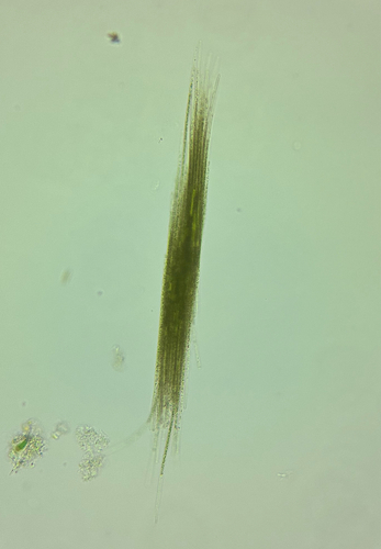 Aphanizomenon flosaquae observed 2026-10-03