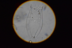Notholca acuminata