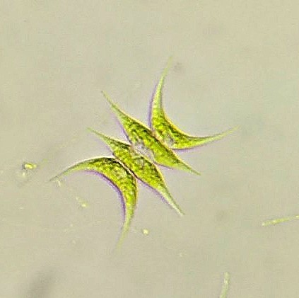 Tetradesmus lagerheimii (Tetradesmus lagerheimii)