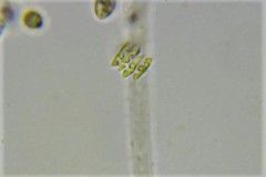 Tetradesmus