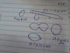 Botryobasidium conspersum