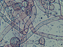 Botryobasidium conspersum