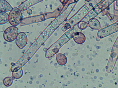 Botryobasidium conspersum