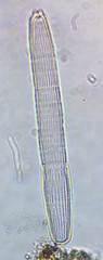Penium spirostriolatum