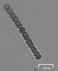 Anabaena