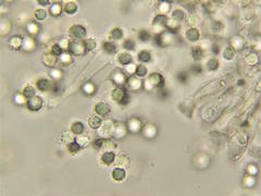 Lactarius subviscidus