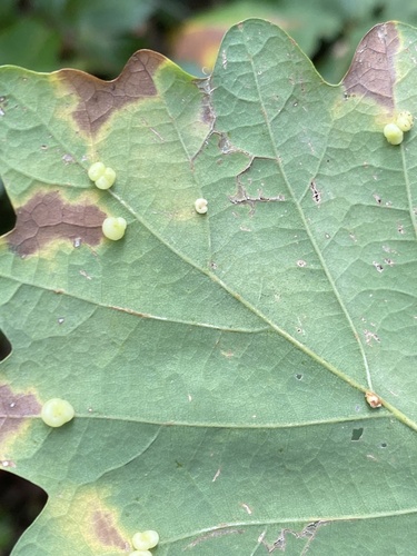 Kidney Gall