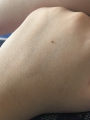 Amblyomma americanum