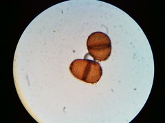 Puccinia orbicula
